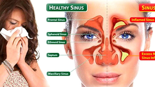 Essential Oils for Sinus Relief: Breathe Better Naturally with Essential Oils